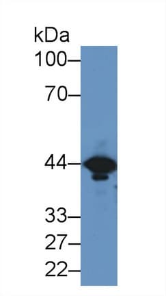 CKM / Creatine Kinase MM Antibody (aa11-367, APC)