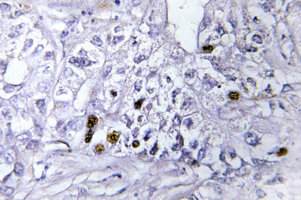 CBX5 / HP1 Alpha Antibody (Lys69)