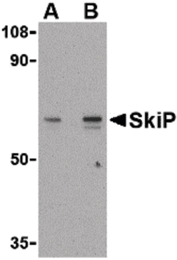 IHC-plus™ SNW1 / SKIP Antibody