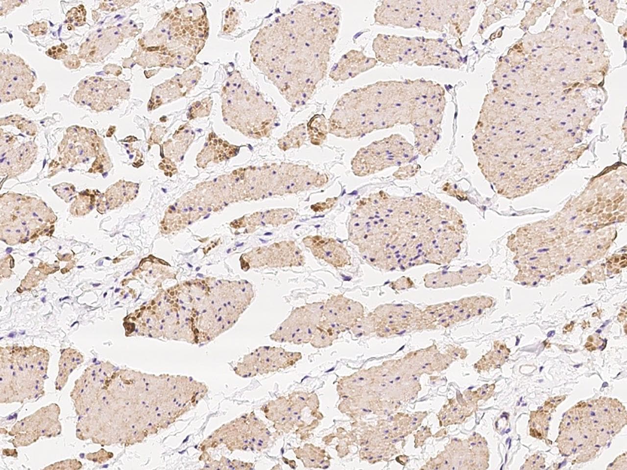 TPM1 / Tropomyosin Antibody