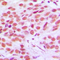 FOSL2 / FRA-2 Antibody (C-Terminus)