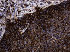 PathPlus™ HSPD1 / HSP60 Antibody (clone OTI3A2)