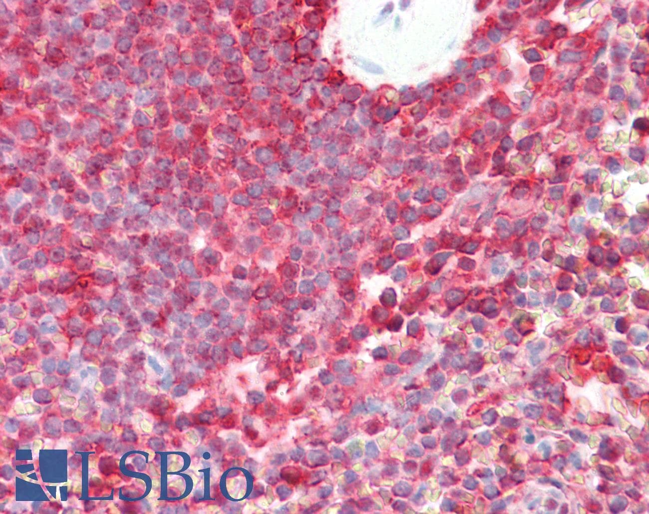 IHC-plus™ Polyclonal Goat anti-Human PSMB8 / LMP7 Antibody (aa263-276, IHC, WB)