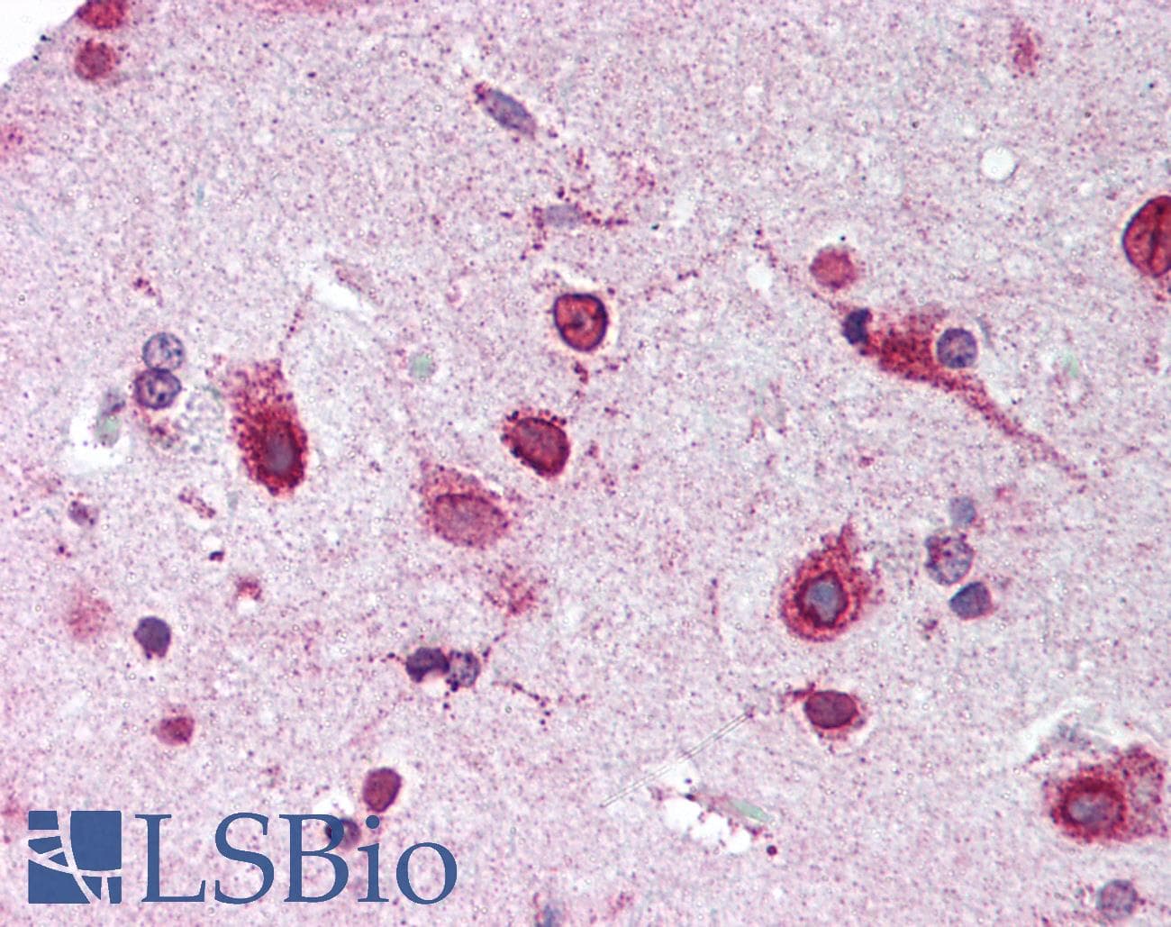 IHC-plus™ Prohibitin 2 / PHB2 Antibody (C-Terminus)