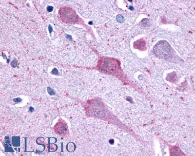 PathPlus™ Polyclonal Rabbit anti-Human GPR1 Antibody (C-Terminus, IHC)
