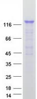Human RALGDS Protein (Recombinant Myc-DDK (Flag))