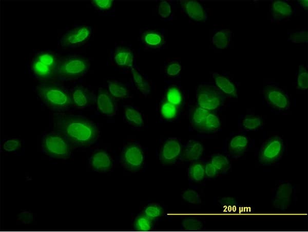 ZNF182 / ZNF21 Antibody (clone 6D11)