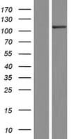 SCYL2 Protein (Over-Expression Lysate Myc-DDK (Flag))