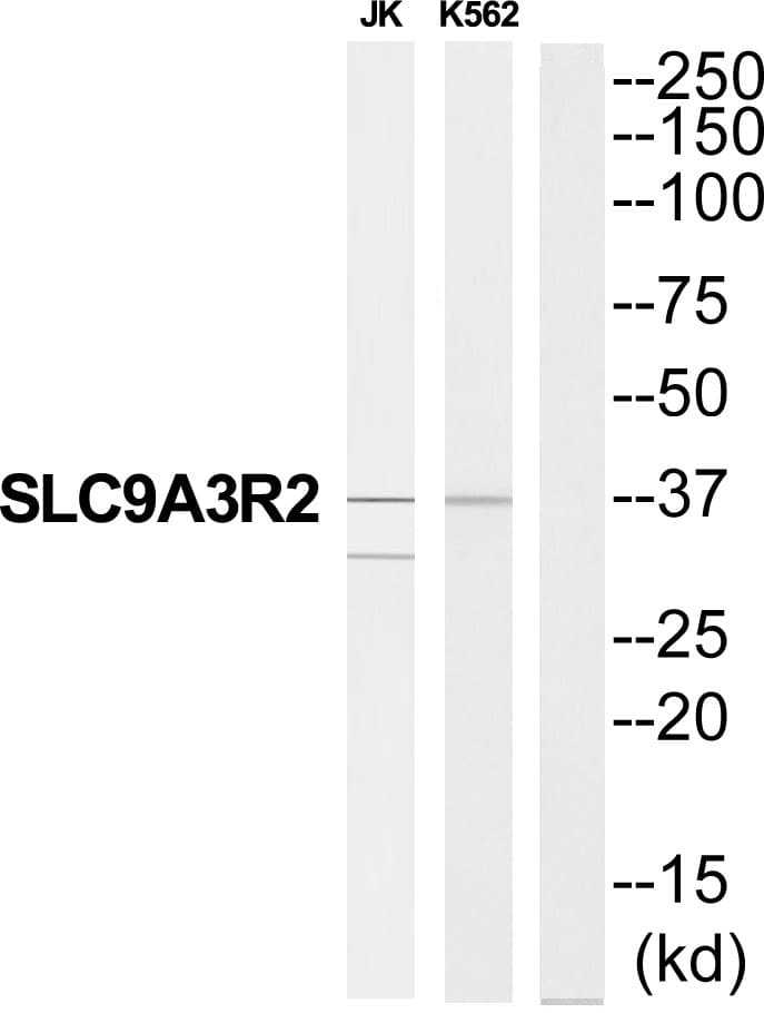 SLC9A3R2 / SIP1 Antibody
