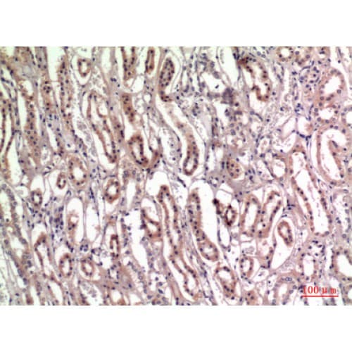 Polyclonal Rabbit anti-Human TNC / Tenascin C Antibody (C-terminal, IHC, WB)