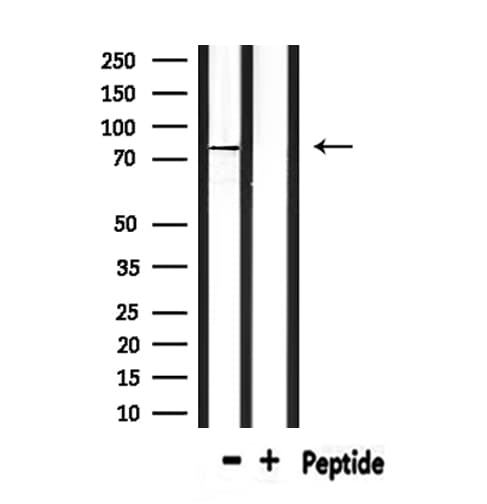 Polyclonal Rabbit anti-Human CPT2 Antibody (IHC, IF, WB)