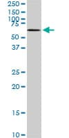 Monoclonal Mouse anti-Human MAK Antibody (clone 3E5, IF, WB)