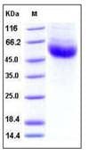 Human IL-22BP / IL22RA2 Protein (Recombinant His,C-terminus)