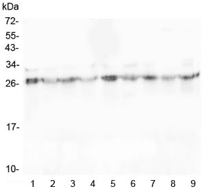 SCN4B Antibody