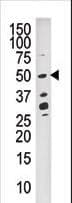 DUSP10 / MKP5 Antibody (aa1-30)