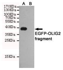 Monoclonal Mouse anti-Human OLIG2 Antibody (WB)