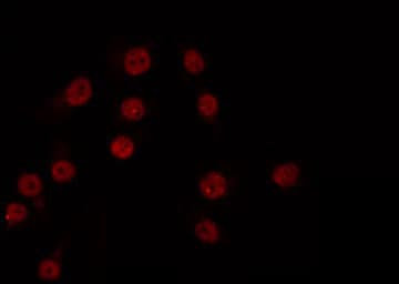 XRN2 Antibody