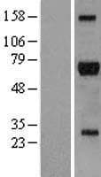 RICK / RIP2 Protein (Over-Expression Lysate Myc-DDK (Flag))