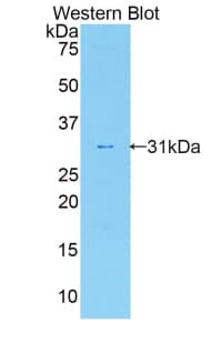 IL17RA Antibody (aa590-848, APC)