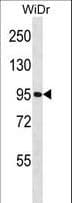 Polyclonal Rabbit anti-Human GNL2 Antibody (aa18-45, WB)