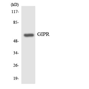 Polyclonal Rabbit anti-Human GIPR / GIP Receptor Antibody (aa83-132, IHC, WB)