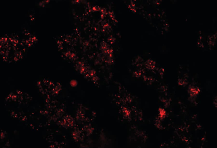 NKX2-6 Antibody