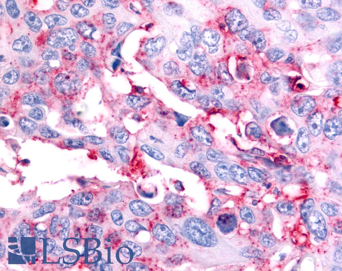 PathPlus™ NR5A2 / LRH-1 Antibody (Internal)