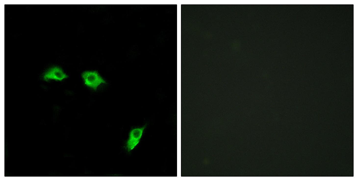 Polyclonal Rabbit anti-Human GABBR1 / GABA B Receptor 1 Antibody (IF, WB)