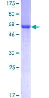 Human STK16 Protein (Recombinant GST)