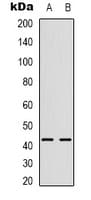 CHKB / CHKL Antibody (C-Terminus)