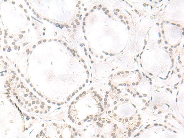 Polyclonal Rabbit anti-Human ARL2BP / BART Antibody (IHC)
