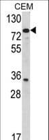 Polyclonal Rabbit anti-Human TGM4 / Transglutaminase 4 Antibody (aa135-164, IHC, WB)