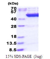 Human CS / Citrate Synthase Protein (Recombinant His)