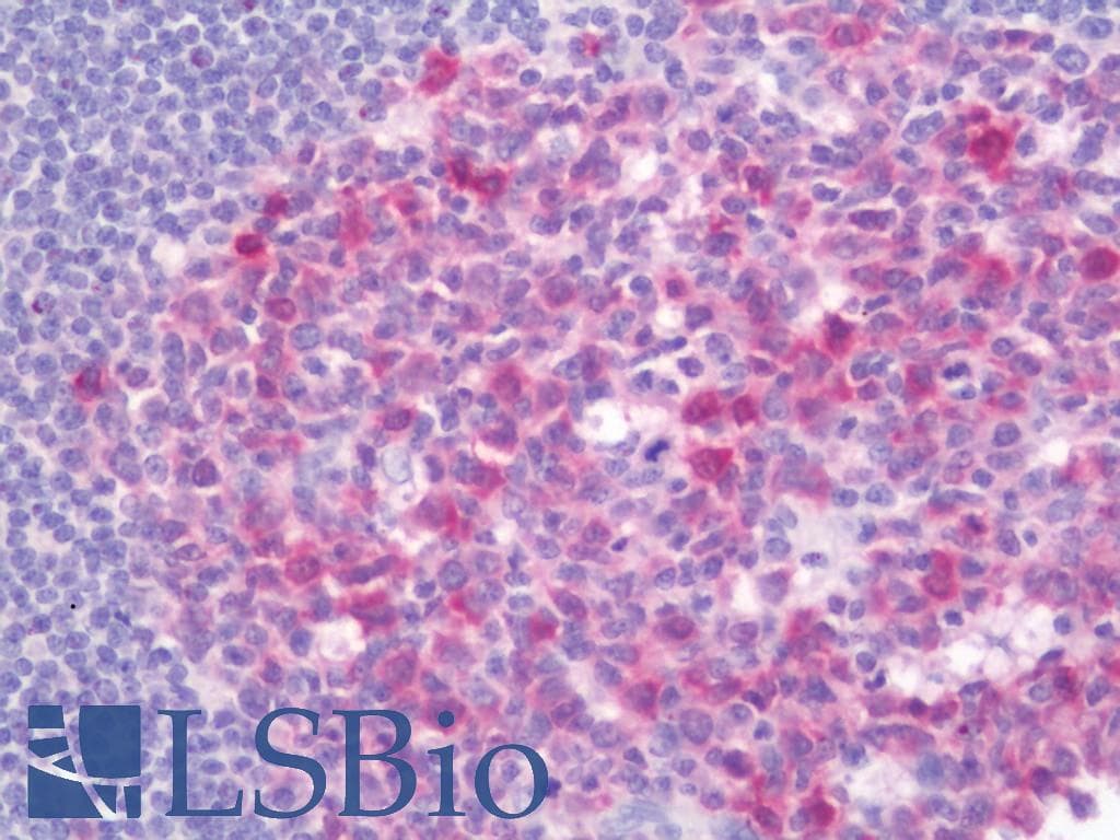 BCAT1 / ECA39 Antibody (clone 3F5, Carrier-free)