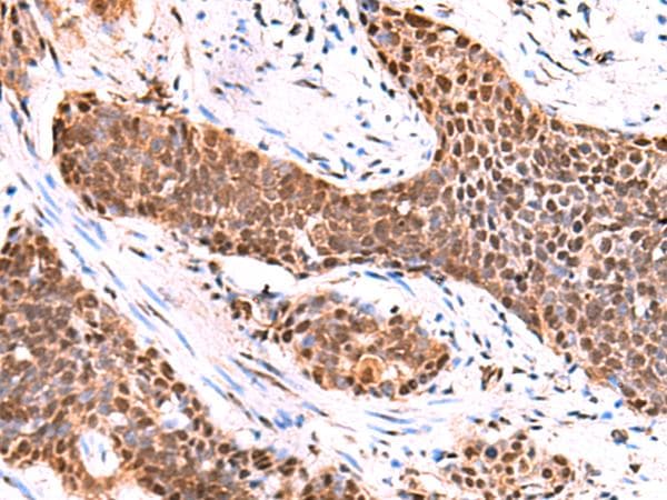 Polyclonal Rabbit anti-Human TSEN2 Antibody (IHC, WB)
