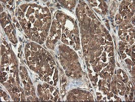 UBE2G2 Antibody (clone OTI4E12)