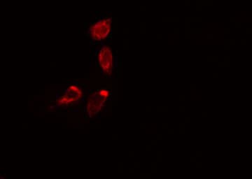 SEPT3 / Septin 3 Antibody