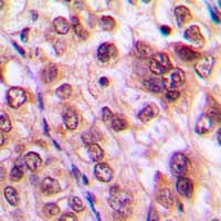 AKT1 + AKT2 + AKT3 Antibody (C-Terminus)