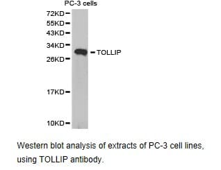 Polyclonal Rabbit anti-Human TOLLIP Antibody (IHC, WB)