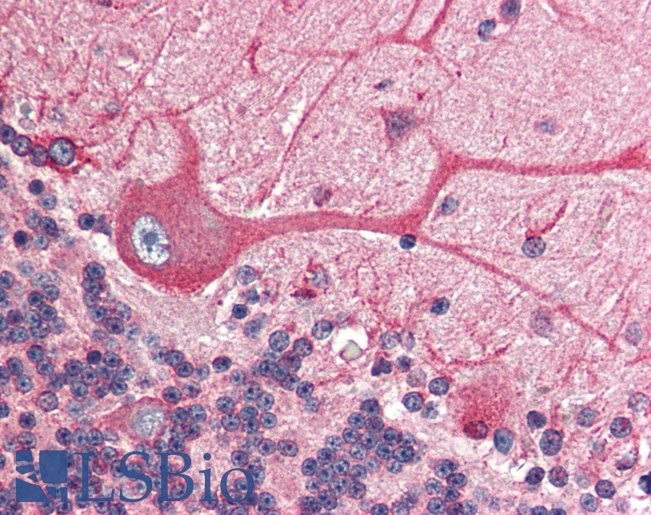 IHC-plus™ BCAP31 / BAP31 Antibody