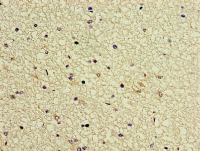 Polyclonal Rabbit anti-Human GTF2H5 Antibody (WB)