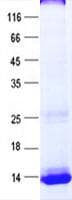 Human ABCC6 / MRP6 Protein (Recombinant His, N-Terminal)