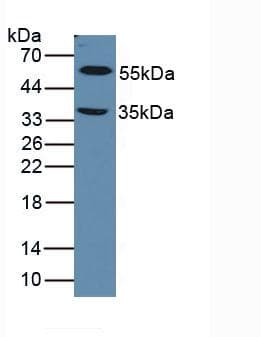 LOXL1 Antibody (aa392-598)