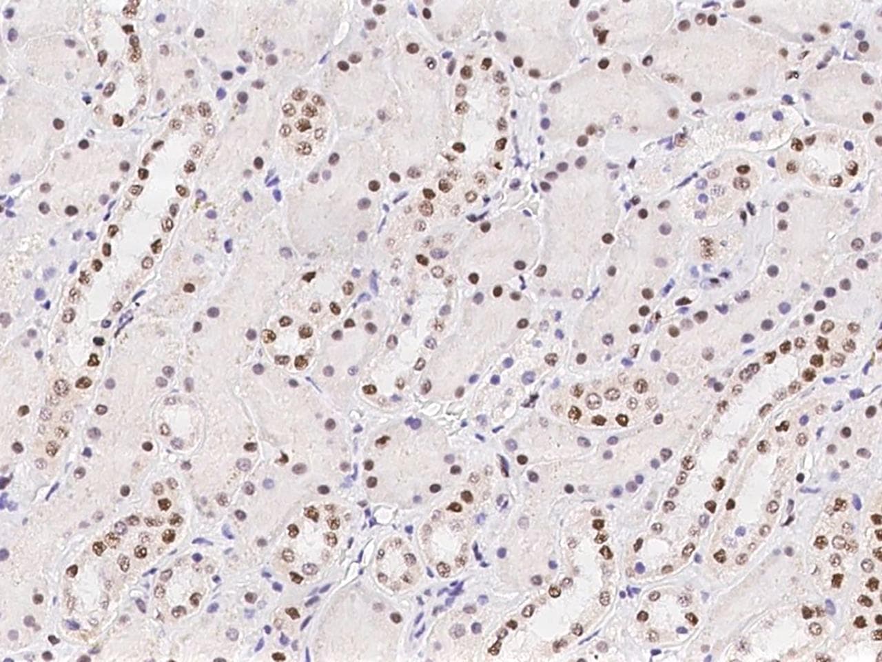 Polyclonal Rabbit anti-Human SCAF8 Antibody (IHC, IF)