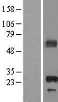 APIP Protein (Over-Expression Lysate Myc-DDK (Flag))