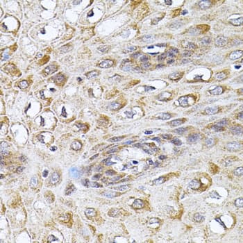 CETP Antibody