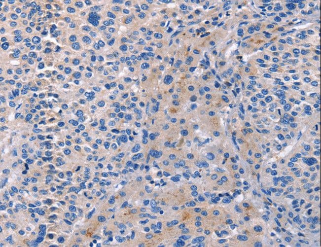 AIM / CD5L Antibody