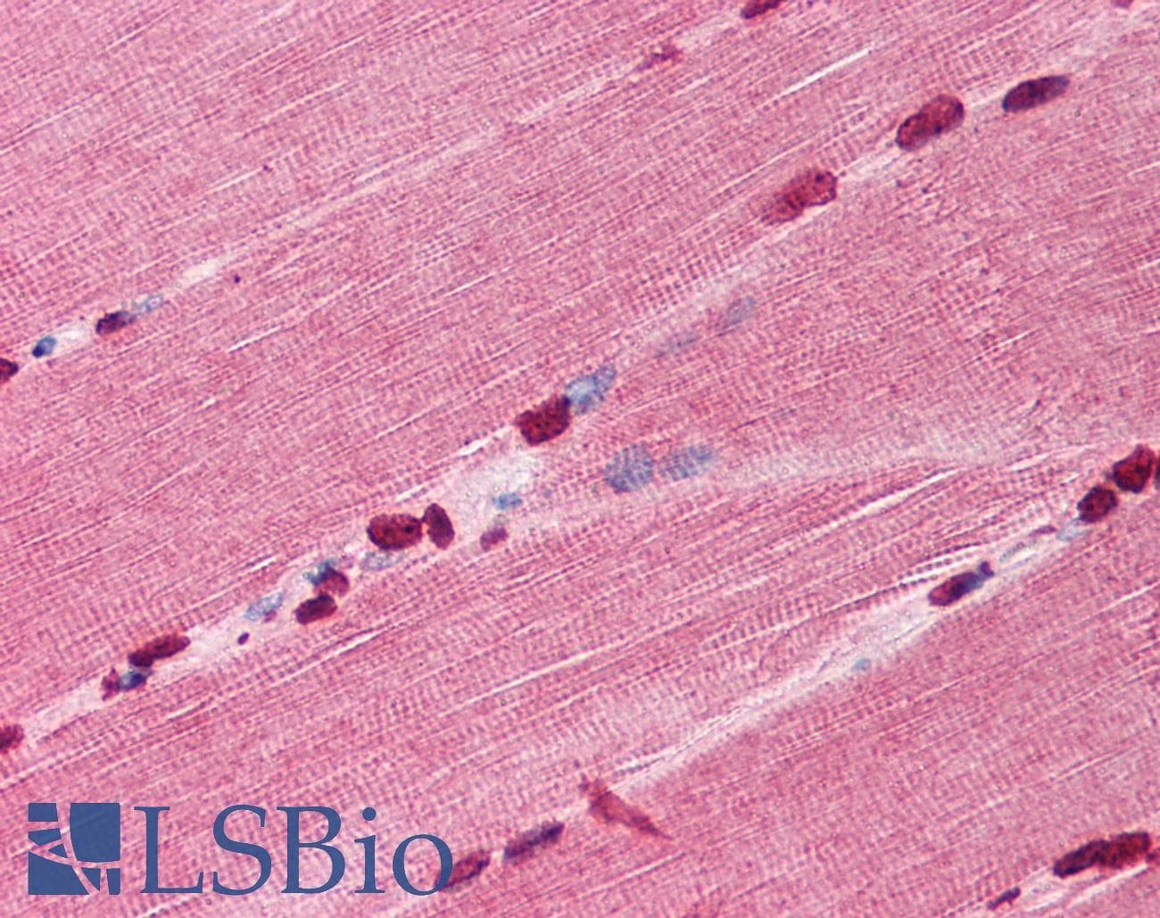 IHC-plus™ Polyclonal Rabbit anti-Human TIRAP Antibody (N-Terminus, IHC, WB)