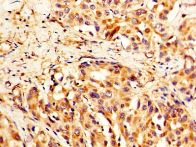 Polyclonal Rabbit anti-Human TLN1 / Talin 1 Antibody (aa92-399, WB)
