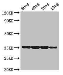 Polyclonal Rabbit anti-Mycobacterium smegmatis dps Antibody (WB)